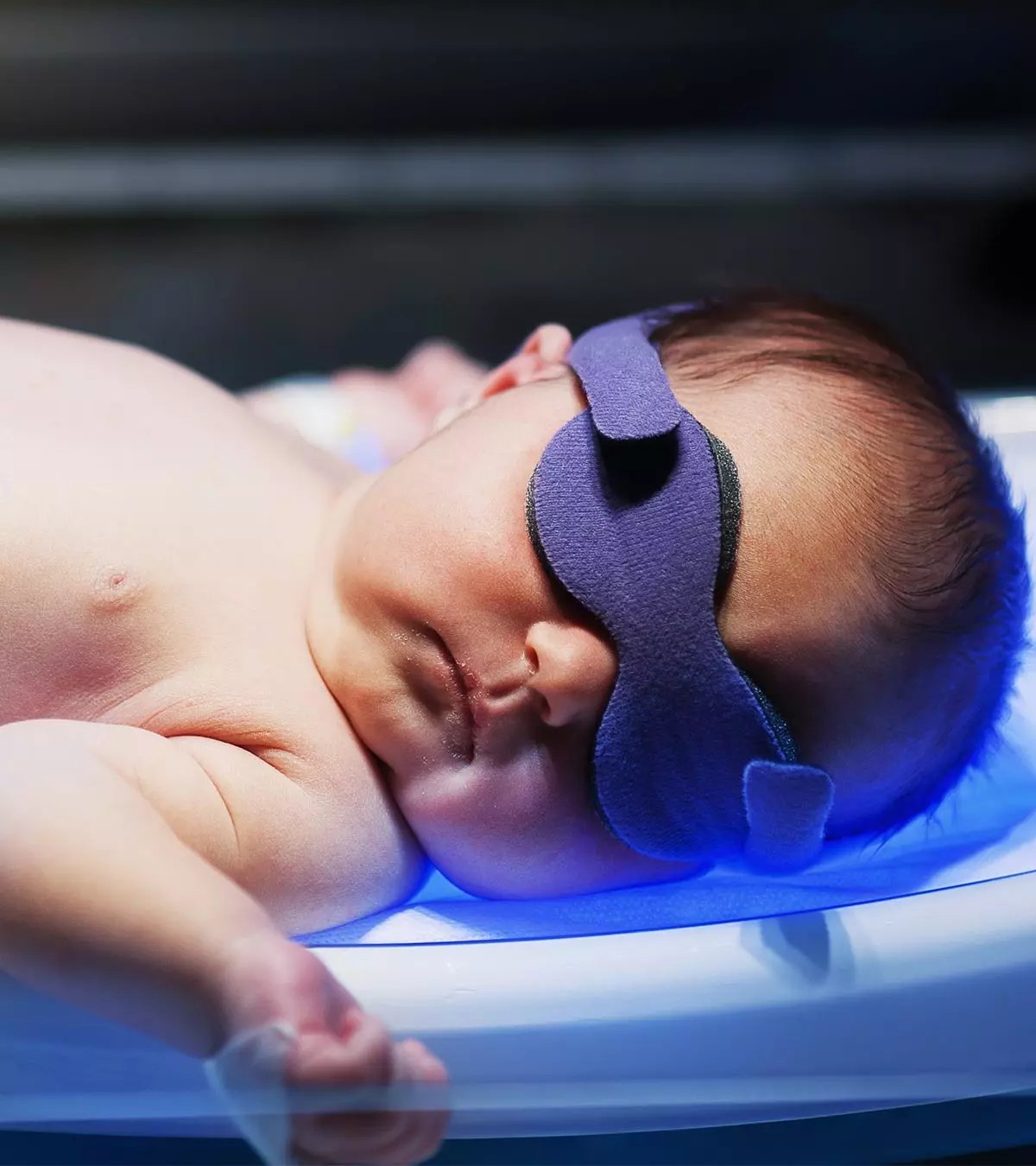 Jaundice In Newborns Causes, Symptoms And Treatment