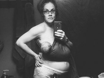 Mum’s Selfie Of Body 24 Hours After Birth Goes Viral