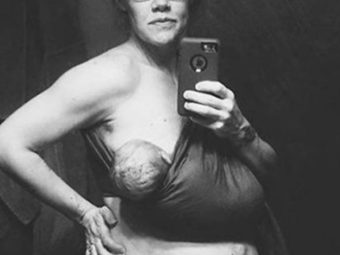 Mum’s Selfie Of Body 24 Hours After Birth Goes Viral