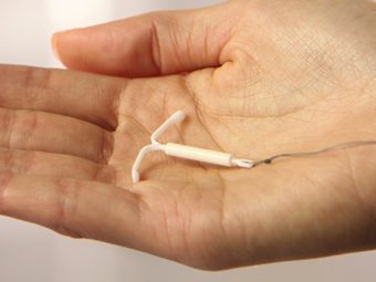 Mirena (IUD) And Pregnancy: Complications And Chances Of Pregnancy