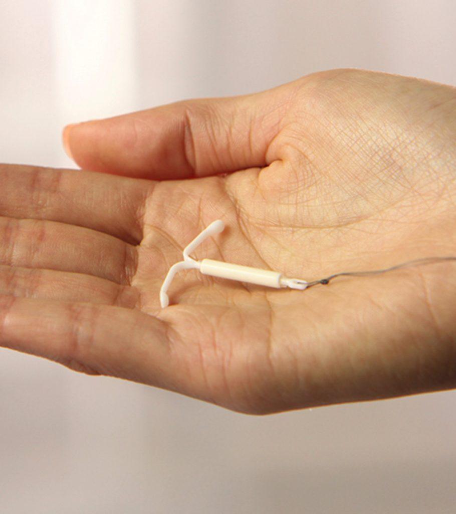 can-you-get-pregnant-with-mirena-iud