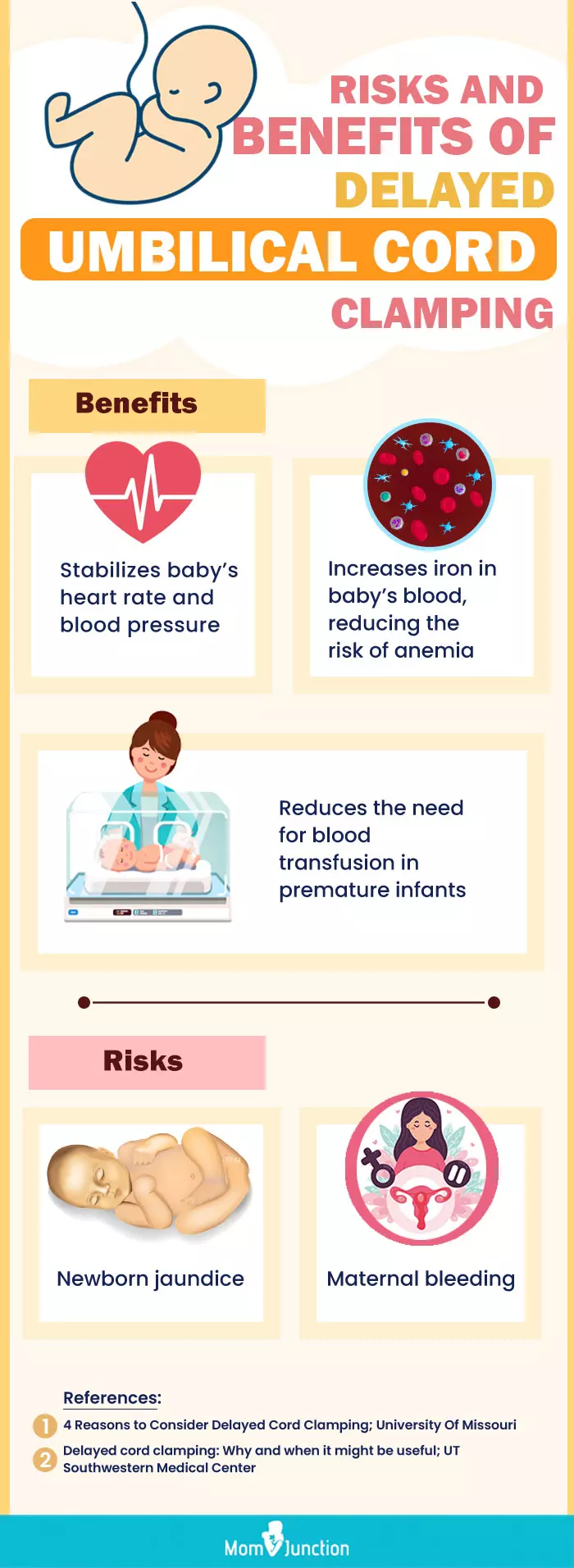 delayed umbilical cord clamping in newborns (infographic)