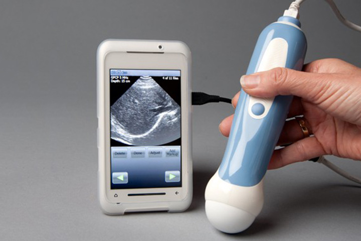 This personal ultrasound machine that you could use on the go as you connect it to your smartphone