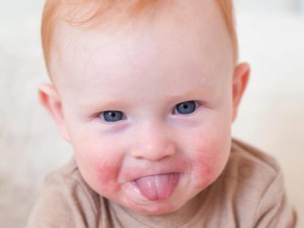 What Cause Rashes In Babies And How To Prevent Them
