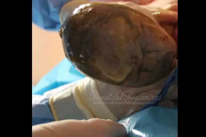 Beautiful Beginnings Birth