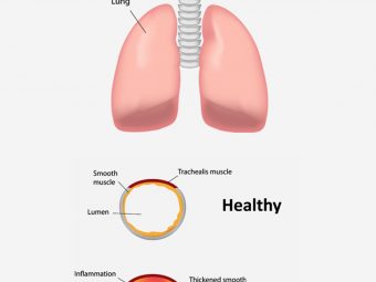 Bronchitis In Children: Symptoms, Causes And Treatment
