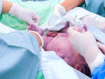C-section Babies Healthier If Mothers Had Labor First
