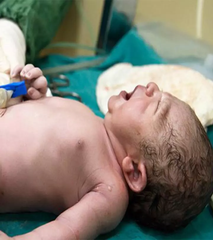 Delayed Cord Clamping Has Positive Effects On Your Baby. Here's How