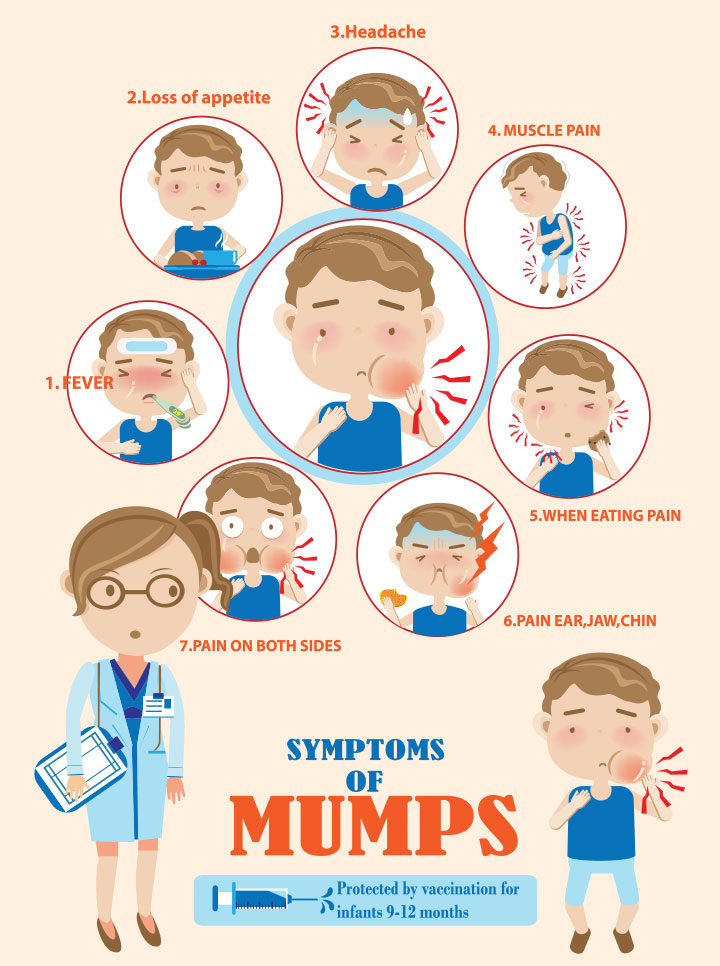 Symptoms of mumps in children