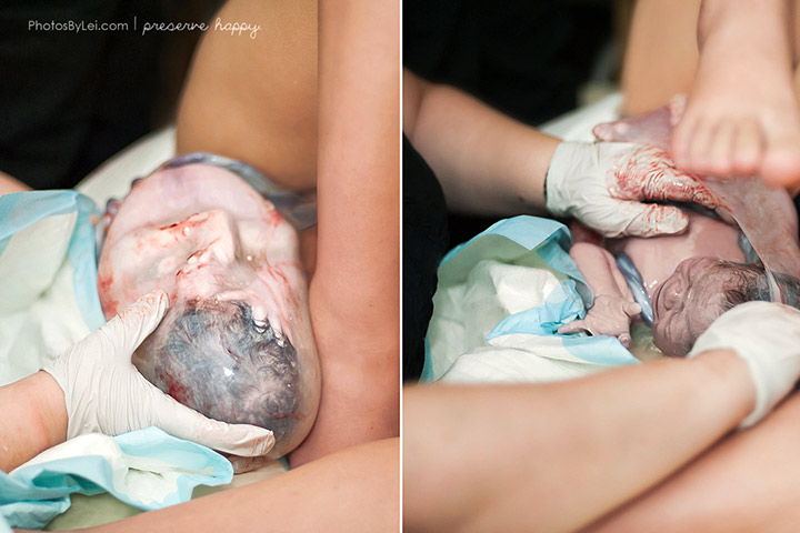 Witnessing a baby born in the amniotic sac in tact is a rare moment