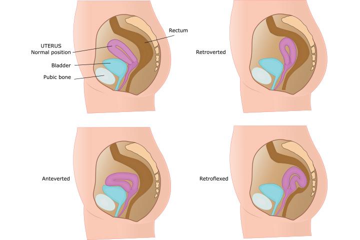 Uterus Size During Pregnancy Chart