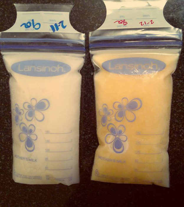 Mom's Pic Of Breast Milk Changing Color Goes Viral