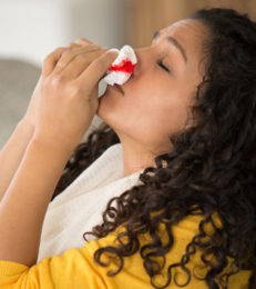Nosebleeds In Teenagers (Epistaxis): Causes, Treatment And When To See A Doctor