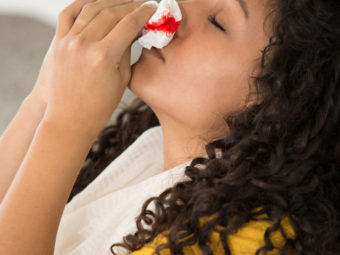 Nosebleeds In Teenagers (Epistaxis): Causes, Treatment And When To See A Doctor