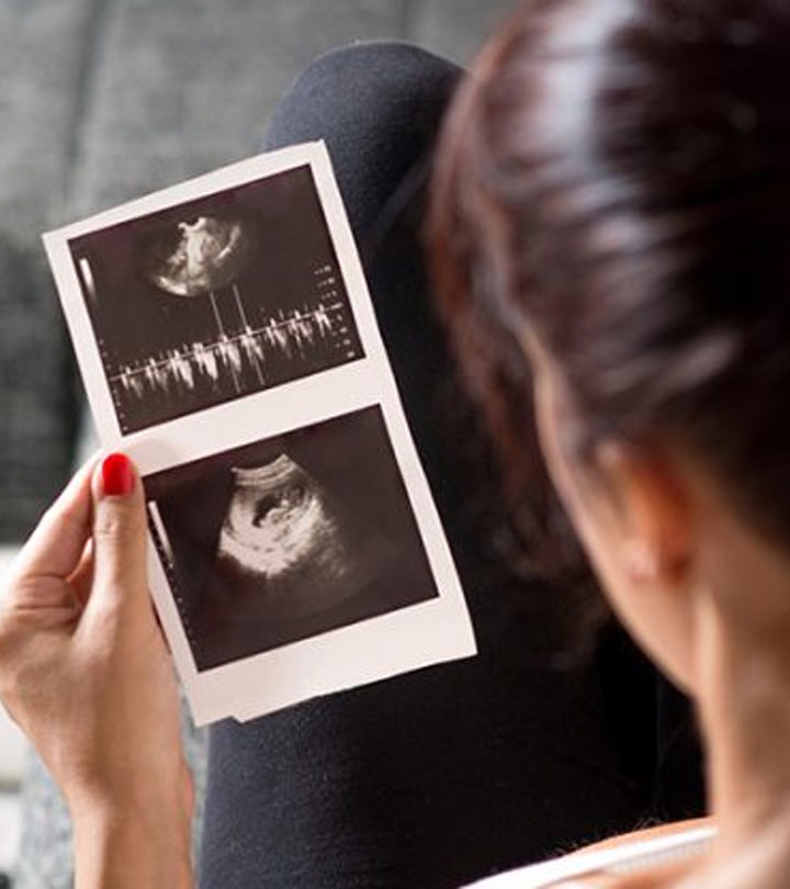 Your First Ultrasound Can Tell The Sex Of Your Baby