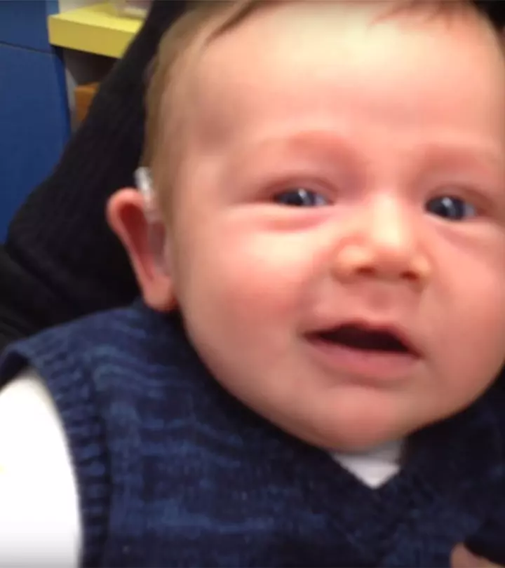 Baby With Congenital Disorder Hears Parents For The First Time