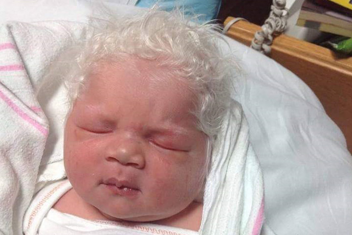 Baby with the whitest hair!