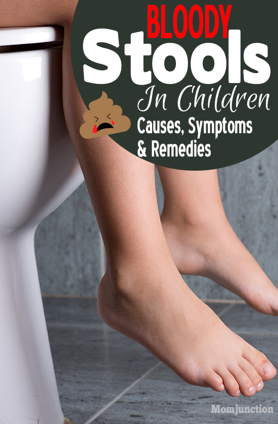 Bloody Stools In Children Causes, Symptoms And Remedies