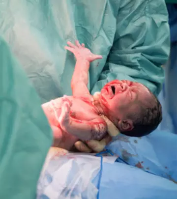 C-Section-Deliveries---How-They-Affect-The-Newborns