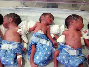 India Has Its First Rare Case Of Premature Quintuplets