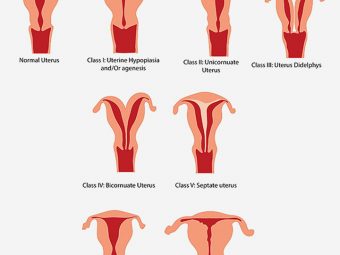 Uterine Abnormalities During Pregnancy - Classification, Symptoms & Treatment