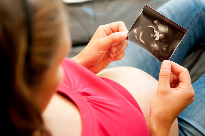 Accuracy Of Nub Theory For Gender Prediction At 11 13 Weeks
