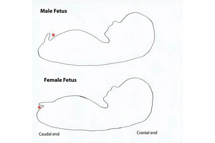 Male & female fetus, nub theory