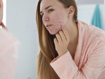 Acne And Breastfeeding: Causes, Treatments And Home Remedies