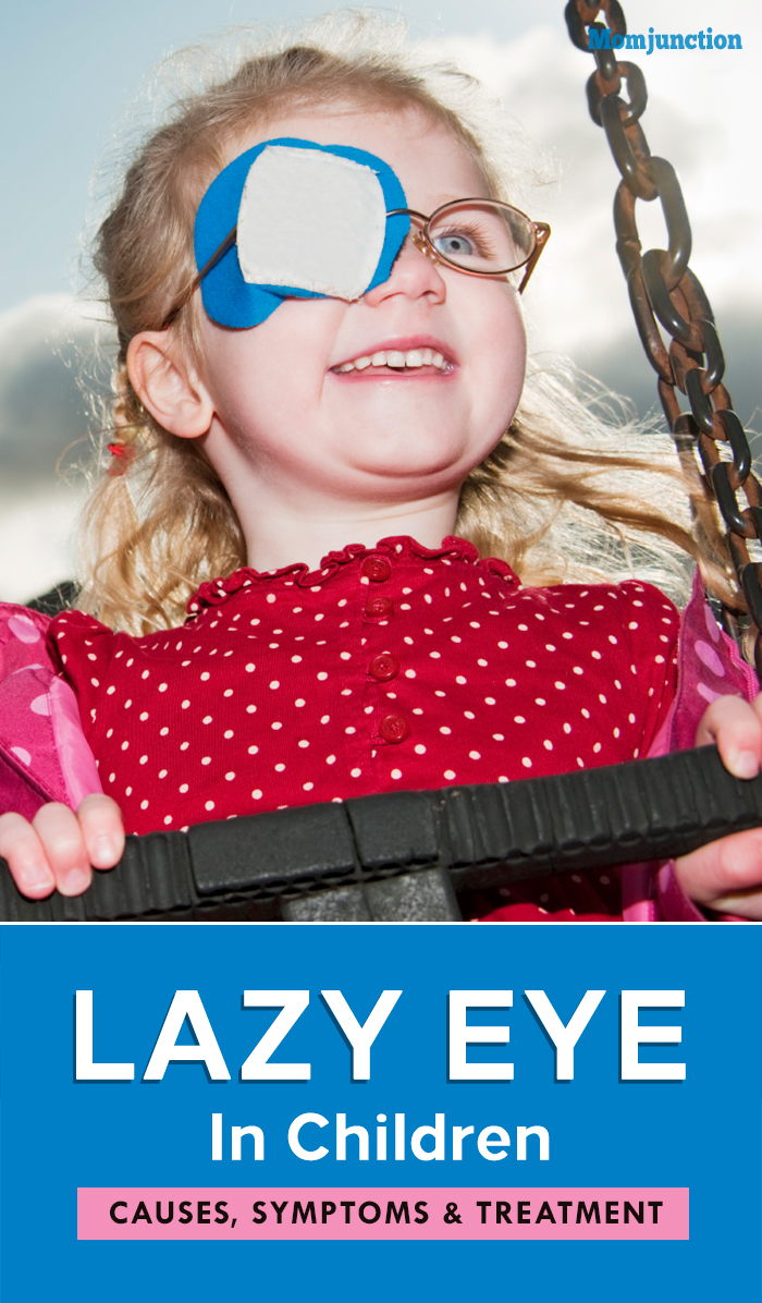 Lazy Eye In Children: Causes, Symptoms, And Treatment