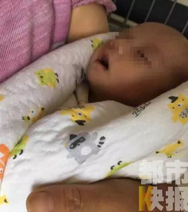 Shocking! Newborn Boy Carries A Fetus Inside