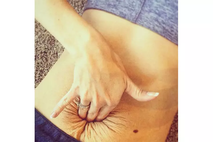 abdominal walls and it was all about functionality