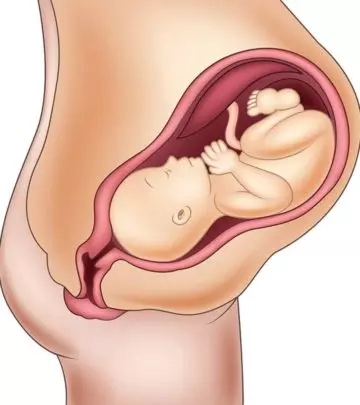 How-A-Baby's-Position-In-Womb-Can-Affect-Your-Delivery