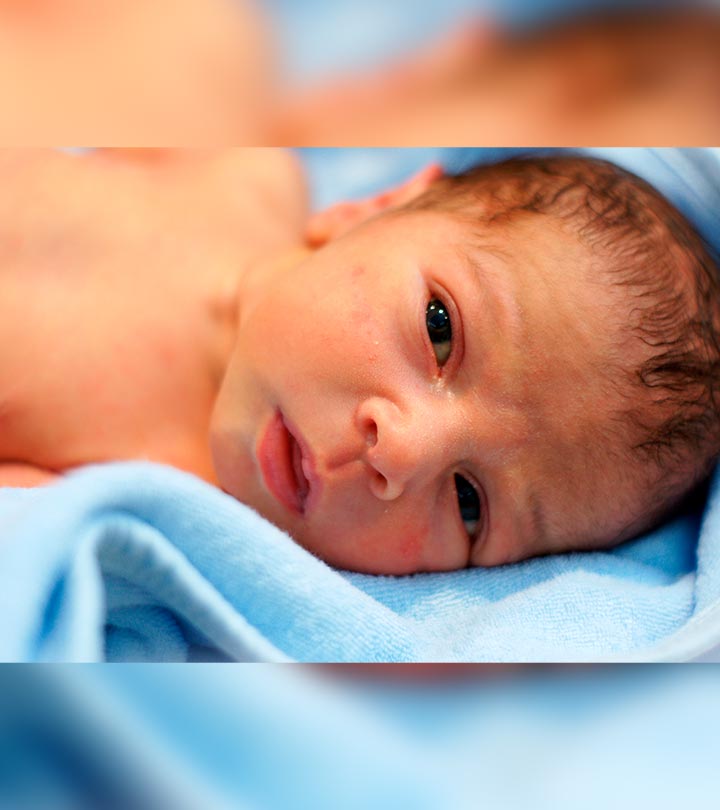 Can My Child's Complexion Change From Dark To How Fair He Was At Birth
