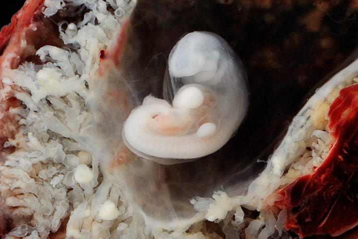 Photos of Human Developing In The Womb1