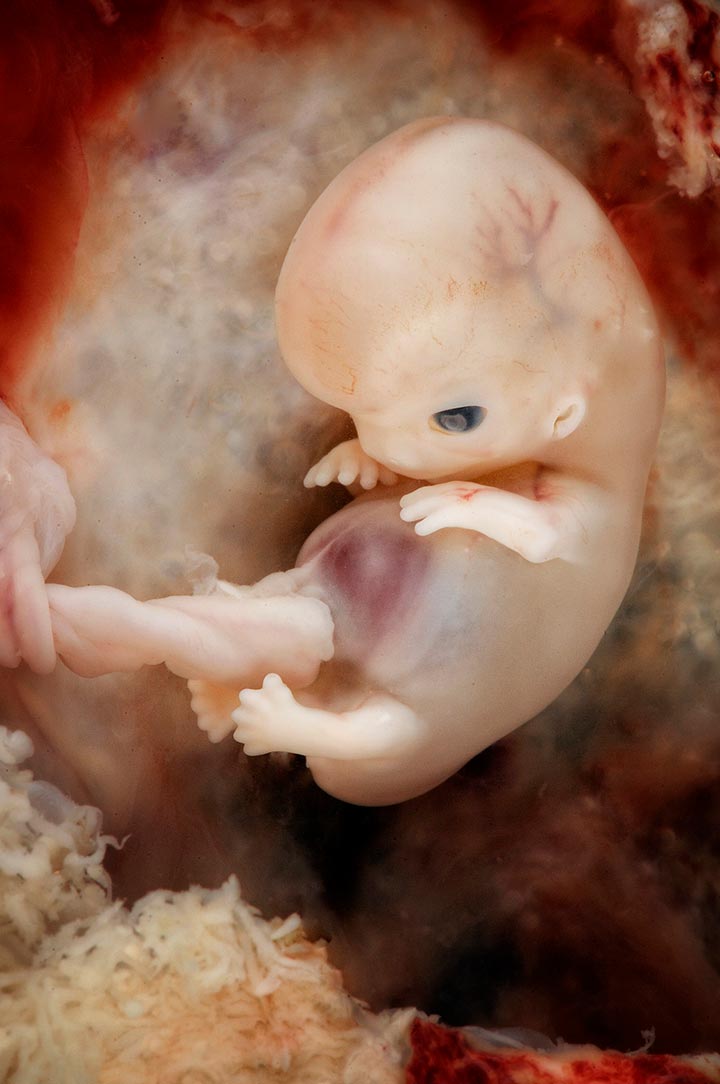 Photos of Human Developing In The Womb10