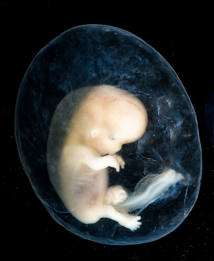 Photos of Human Developing In The Womb11