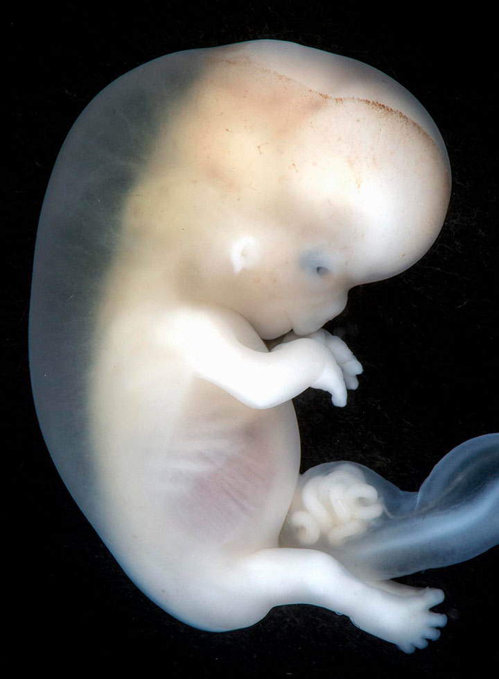 Photos of Human Developing In The Womb12