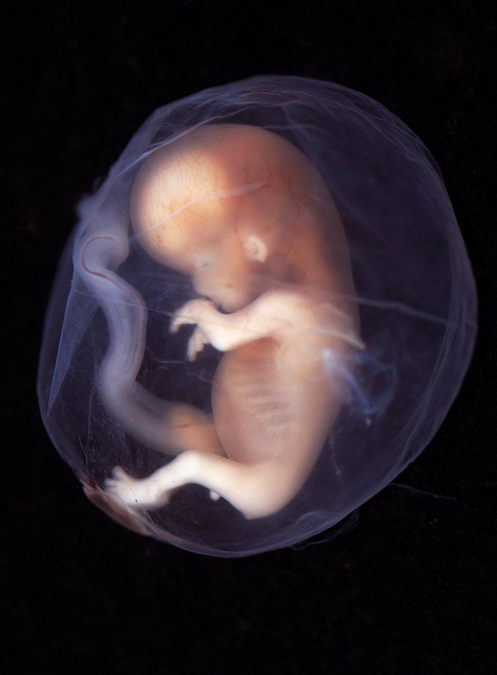 Photos of Human Developing In The Womb13