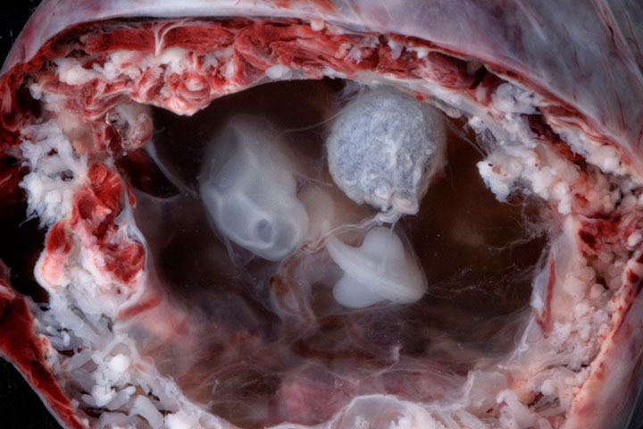 Photos of Human Developing In The Womb2