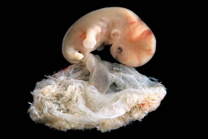 Photos of Human Developing In The Womb4