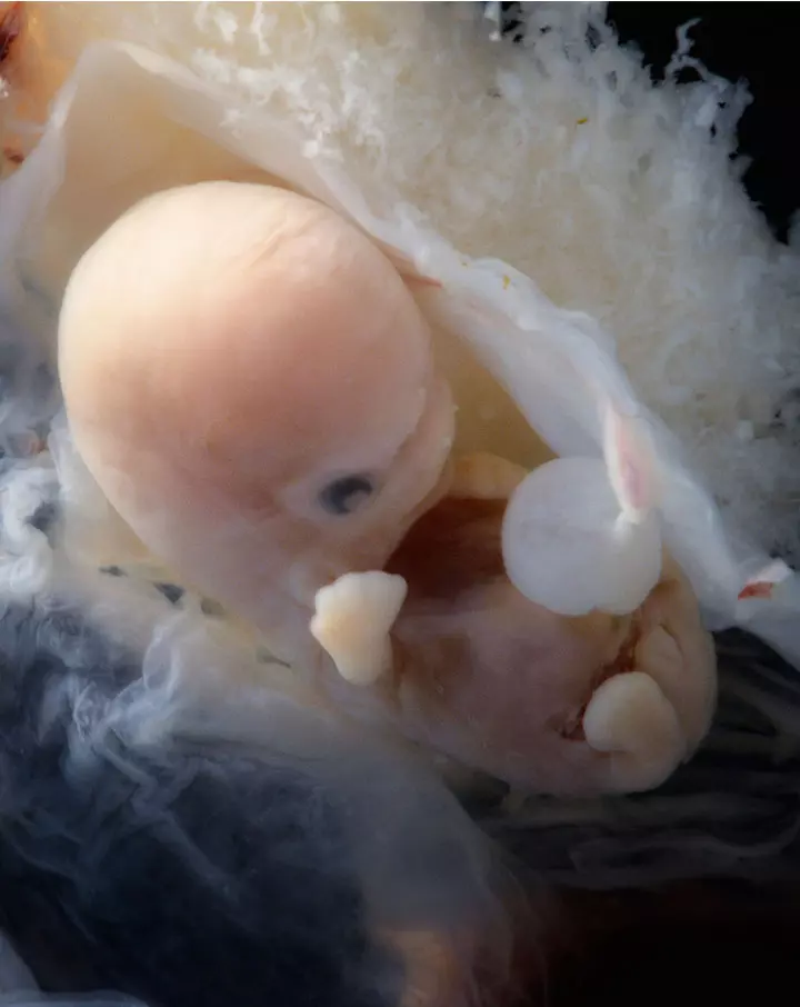 Photos of Human Developing In The Womb5