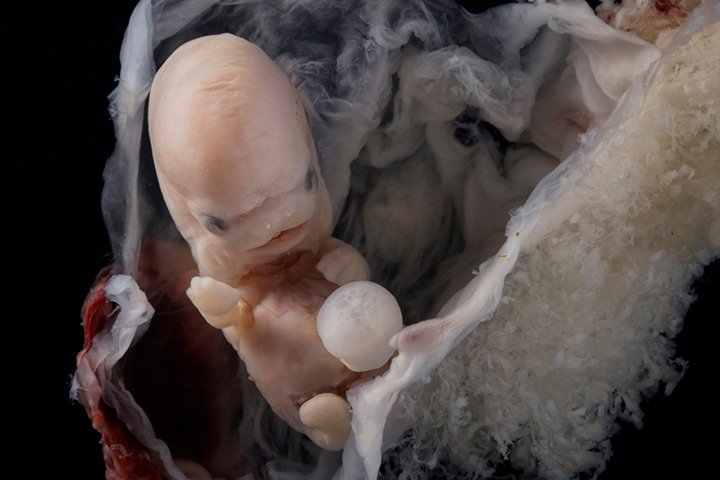 Photos of Human Developing In The Womb6