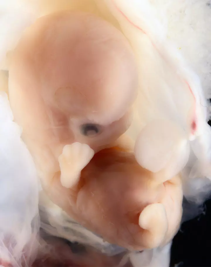 Photos of Human Developing In The Womb7