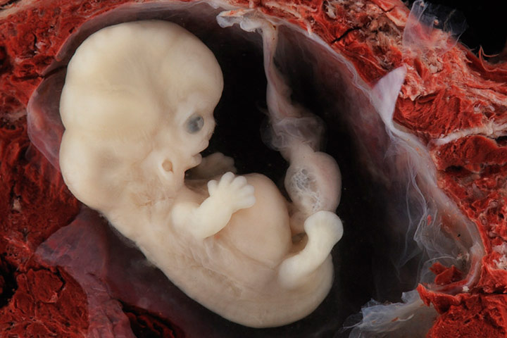Photos of Human Developing In The Womb8