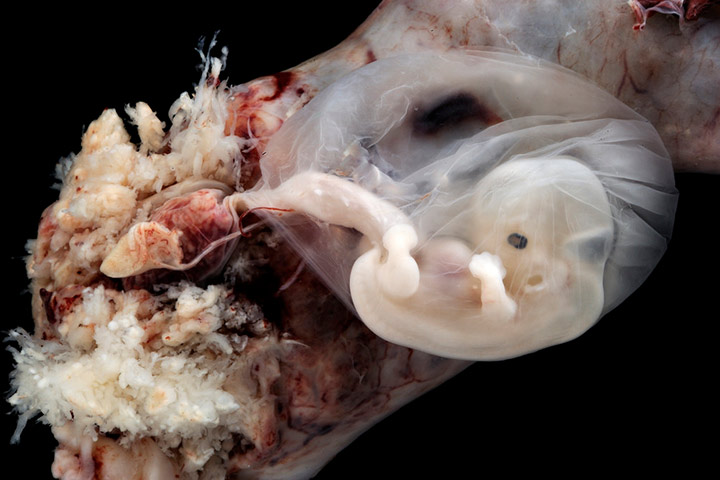 Photos of Human Developing In The Womb9