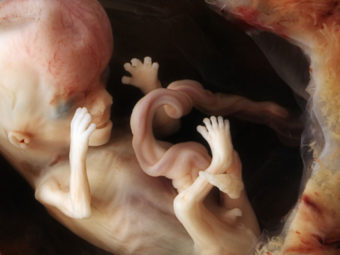 Stunning Photos of Human Developing In The Womb