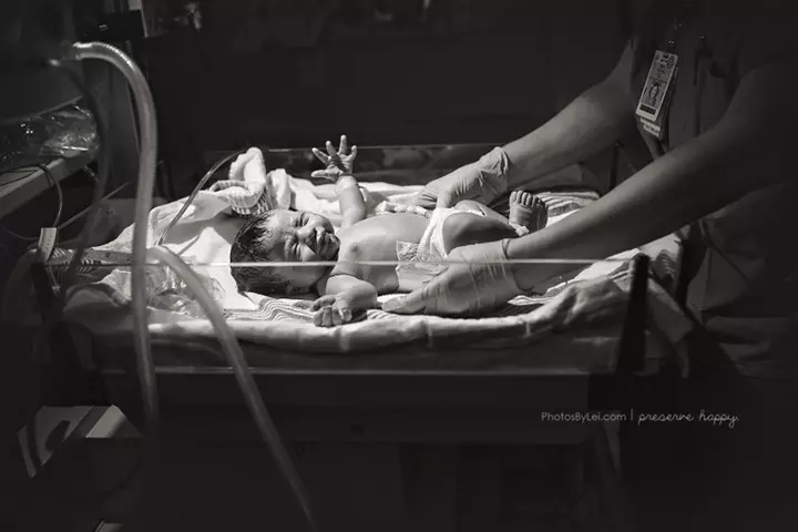 This was after Oliver was cleaned up after his skin-to-skin bonding time.