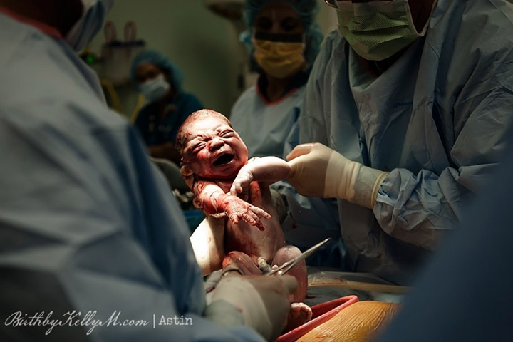 Birth Photos Will Make You Want To Be A Mother Again9