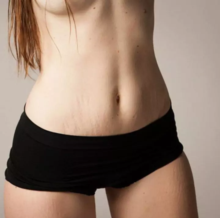 Post-Pregnancy Bodies1