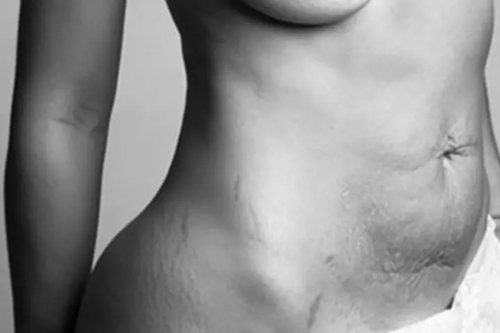 Post-Pregnancy Bodies8